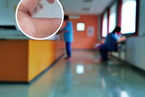 白點癲風(fēng)忌口食物有哪些呢